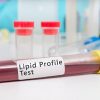 Lipid profile - zydus healthcare