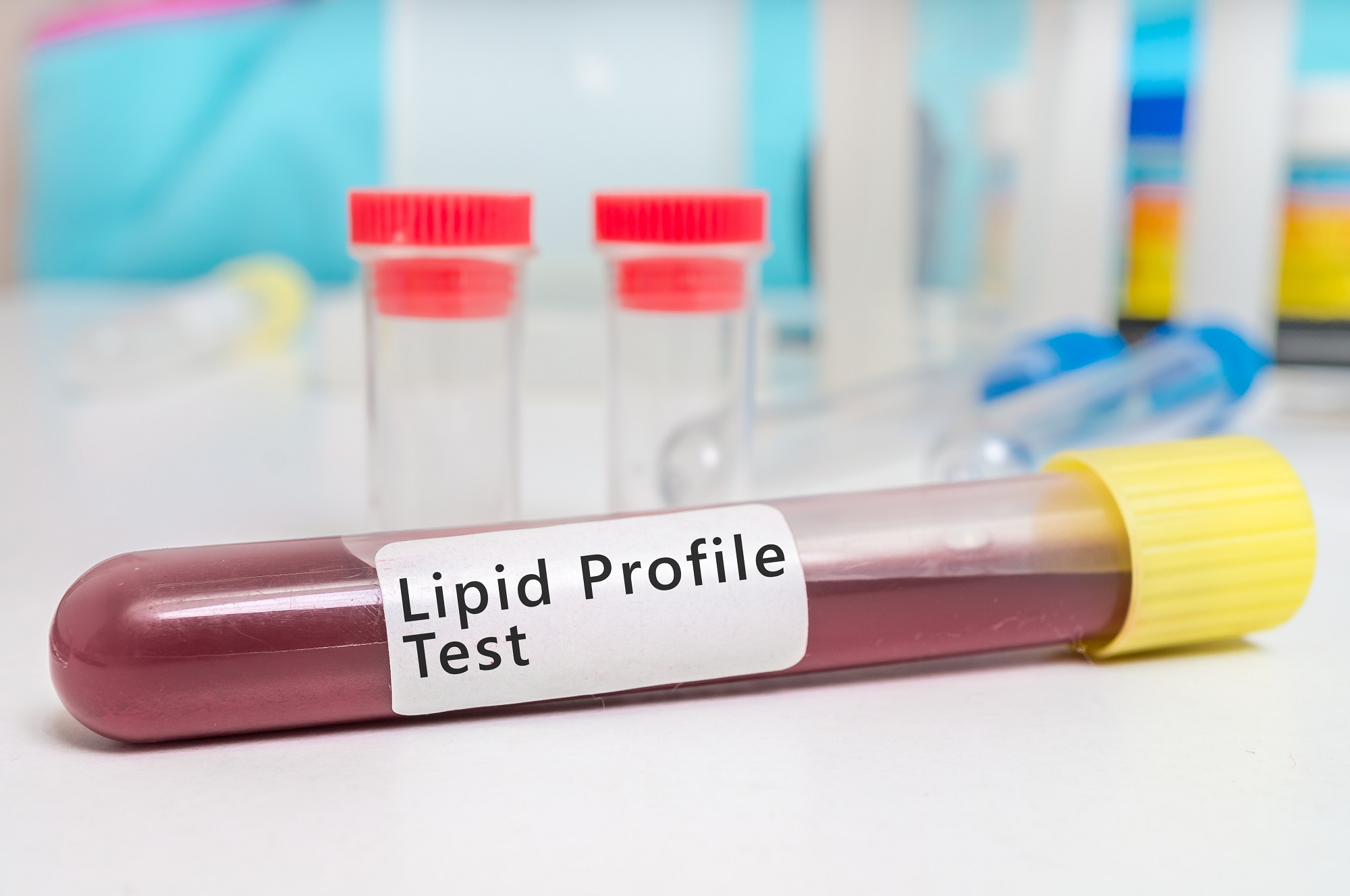 Lipid profile - zydus healthcare