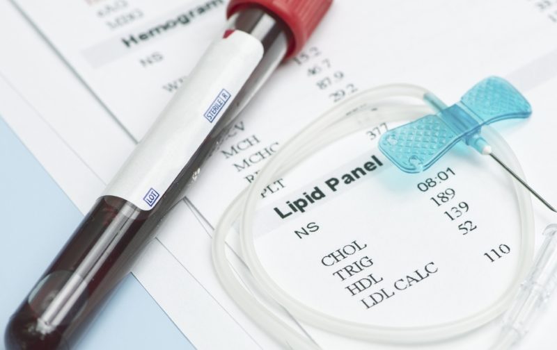 Why Should You Get a Lipid Profile Test at Home?