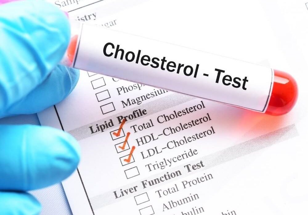 Cholestrol test - zydus healthcare