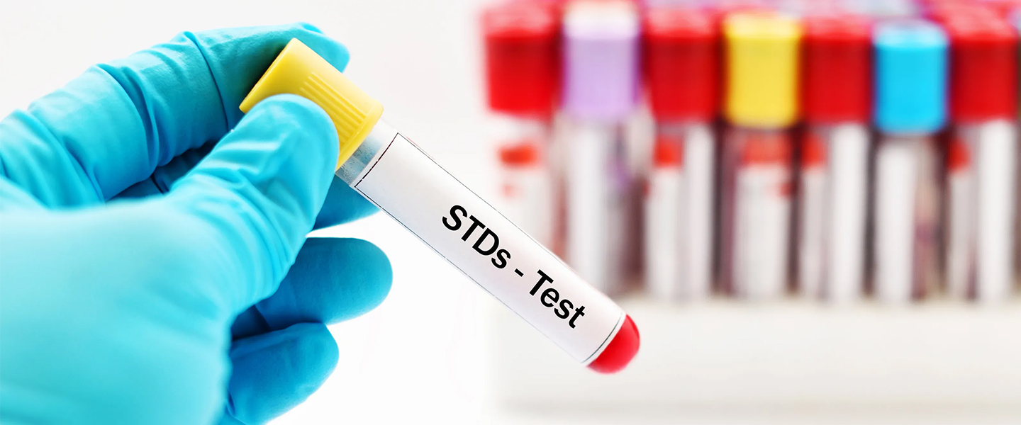 7 Reasons to Take STD Testing for Your Well-Being