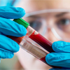 Blood Tests for Detecting Improper Lung Functioning