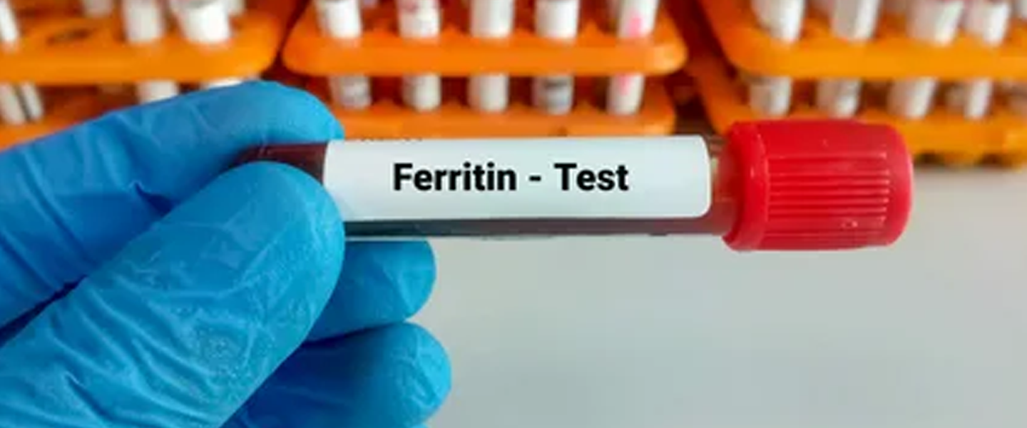 What to Know about Ferritin Level Blood Test